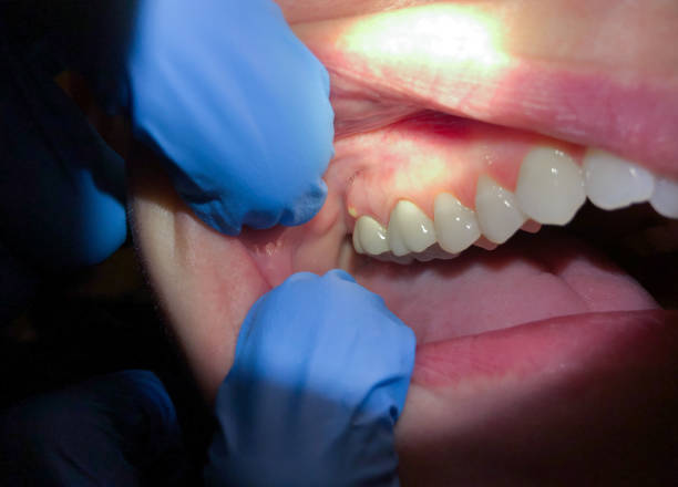 Best 24-Hour Emergency Dentist in Wynnewood, OK