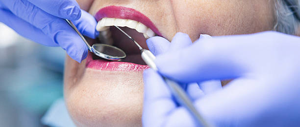 Best Emergency Tooth Extraction in Wynnewood, OK