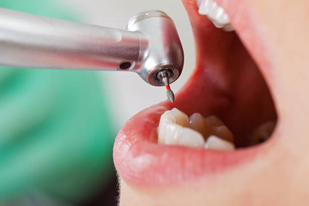 Best After-Hours Emergency Dentist in Wynnewood, OK